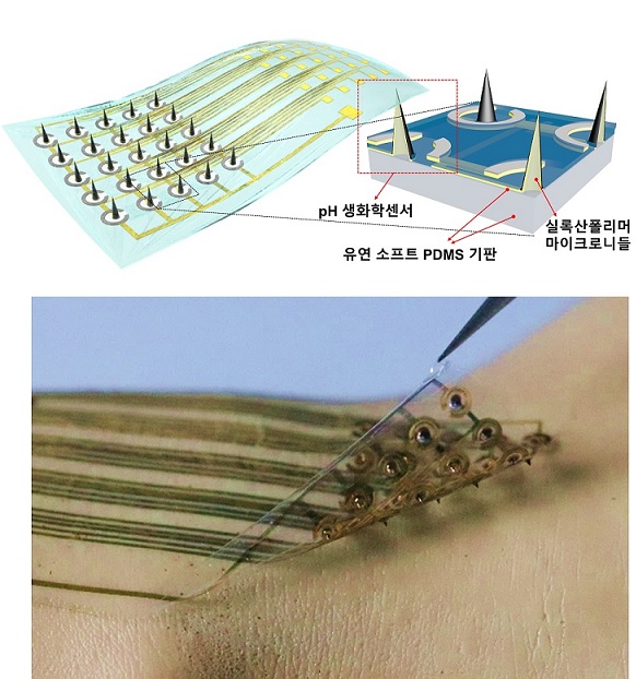 그림 1. 연구에서 개발한 플렉서블 마이크로니들 생화학센서의 개요도 및 실제 사진
