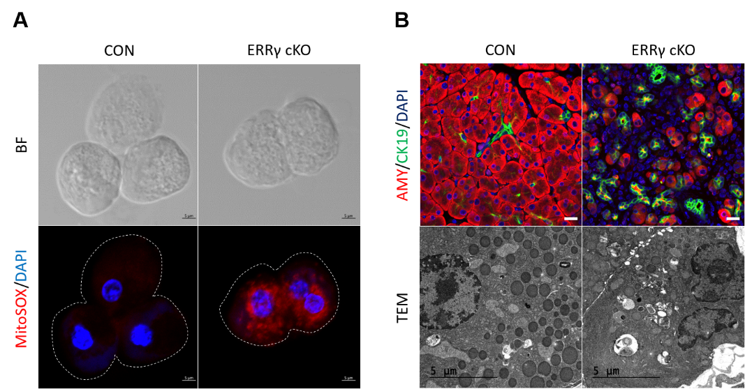 그림 2. ERRγ 유전자 결손에 의해 미토콘드리아에 심각한 활성산소가 발생하였으며, 이로 인해 췌장 선방세포가 세포사멸로 가거나 선방세포의 정체성을 잃어버리는 것을 관찰하였다.