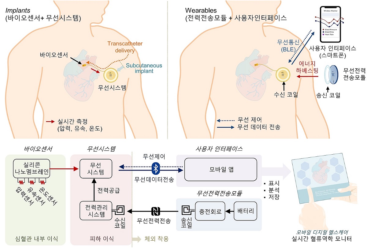 그림 1. 임플란트 장치는 (1) 혈관 내부에 삽입되어 압력, 유속 및 온도를 측정하는 바이오 센서와 (2) 하부피막층에 삽입되어 무선 전력 수급 및 무선 데이터 전송을 지원하는 무선 시스템으로 구성된다. 외부 웨어러블 장치는 (1) 무선 시스템을 무선으로 제어하고 통신하는 사용자 인터페이스와 (2) 무선 시스템에 전력을 전송하는 외부 무선 전력 전송 모듈로 구성된다. 외부 웨어러블 장치는 셔츠나 조끼 주머니에 넣어 놓을 수 있어, 무선 전력 전송 코일의 정렬이 유지된다. 사용자 인터페이스는 무선 측정값의 저장 및 분석 그리고 혈액의 유속, 압력, 온도 데이터의 실시간 디스플레이를 제공하여, 환자들이 어디에서든 신속하게 혈액 역학 이상을 탐지하고 특성화할 수 있는 사용자 친화적인 방법을 제공한다.