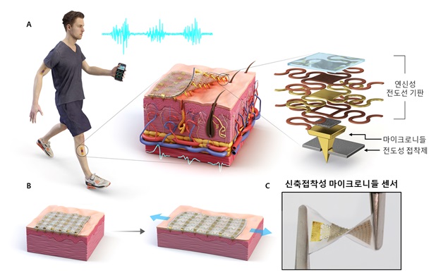 그림 1. 신축·접착성 마이크로니들 센서. (A) 고품질의 전기생리신호 측정이 가능한 신축·접착성 마이크로니들 센서에 대한 개념도, (B) 피부의 신축에 따라 동적으로 순응하는 신축·접착성 마이크로니들 센서, (C) 신축·접착성 마이크로니들 센서 사진