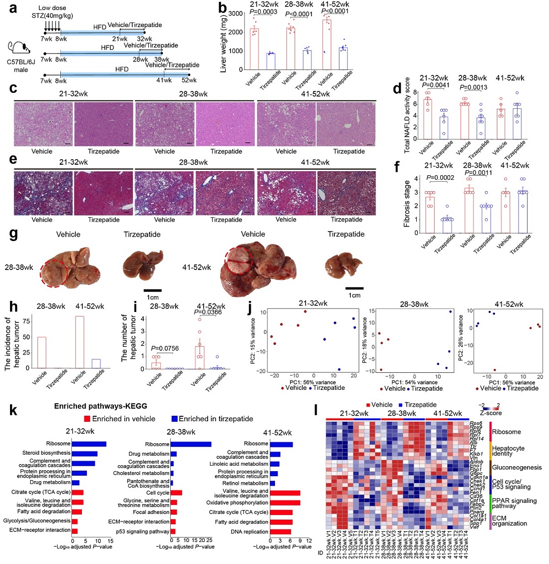 그림 4. GLP-1 유사체의 대사이상 지방간염, 간 섬유와, 간 종양발생의 개선 효과. 대사이상 지방간 질환 마우스 모델에 Tirzepatide의 처리에 따른 대사이상 지방간염, 간 섬유화, 및 간 종양발생을 개선 (a-h). Tirzepatide 처리에 따른 마우스 모델의 간 전사체를 분석해 본 결과, 대사이상 지방간염이 진행됨에 따라 발생한 분자 변화를 부분적으로 복구 (j-i).