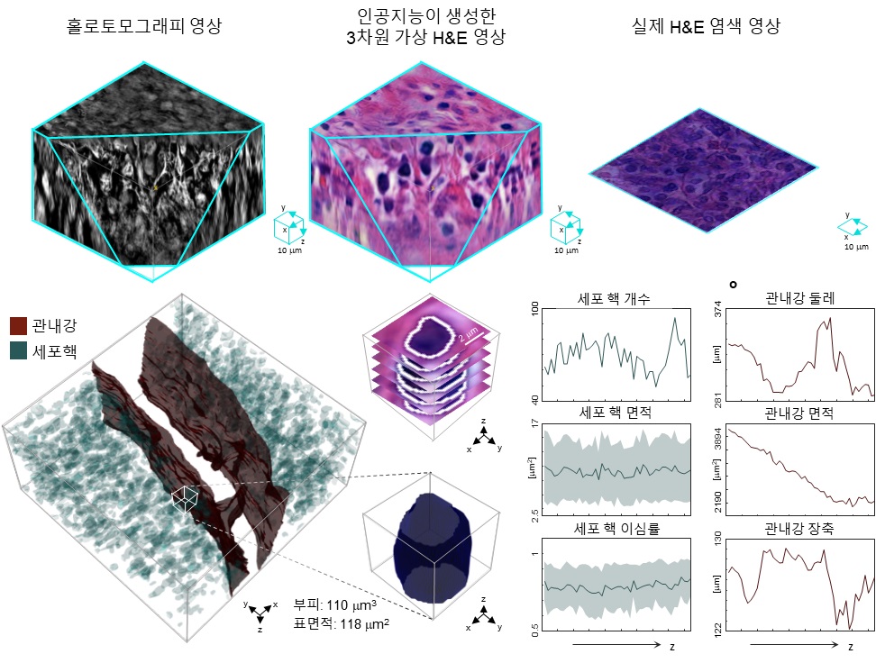 그림 2. 인공지능 기반 3차원 가상 H&E 염색 및 병리 조직의 정량 분석 결과. 가상 염색된 영상은 세포핵, 관내강 등 주요 병리학적 특징을 3차원으로 복원하였으며, 이를 바탕으로 세포핵의 분포, 부피, 표면적 등 다양한 정량 지표를 추출할 수 있었다.